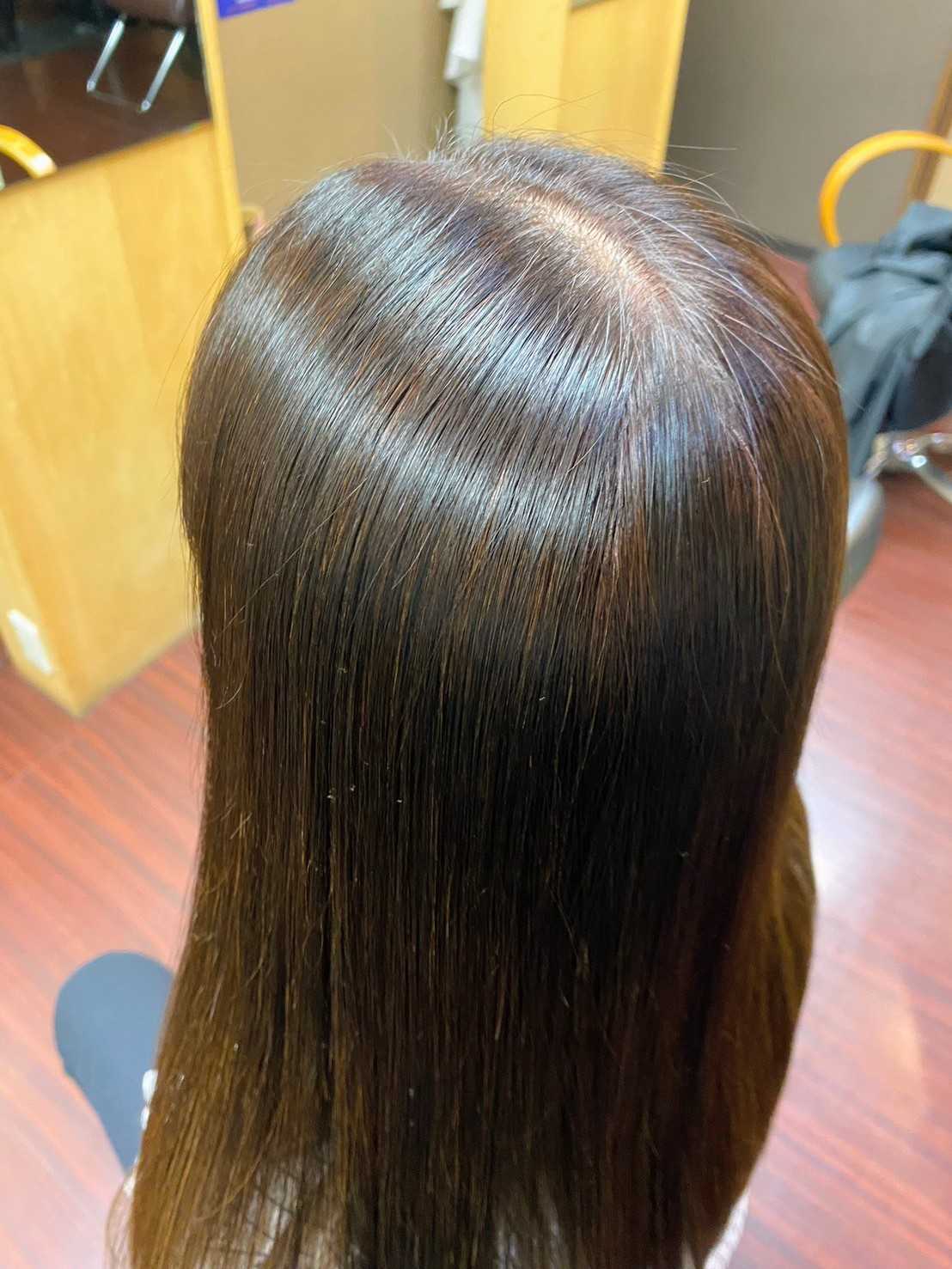 施術後の仕上がり例 B-2